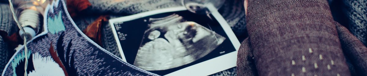 Week 10 zwangerschap Kraamzorg de waarden echo